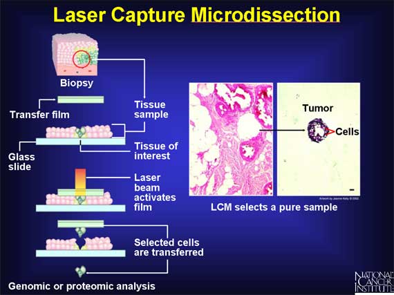 Laser Capture Microdissection