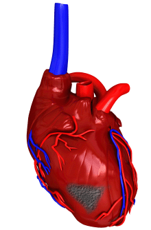 an illustration of a heart showing a grey damaged area.