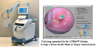 (Photograph of the device. Also, example of a color map generated by the LUMA system to help a doctor decide where to biopsy cervical tissue.)