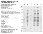 Phast Plate IEF Gel image