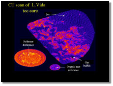 Computed tomography (CT) image