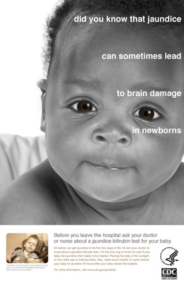 Afiche:¿Sabía usted que la ictericia puede causar algunas veces daño cerebral en los recién nacidos?