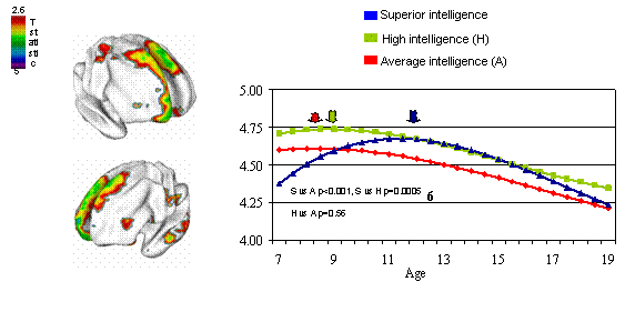 a graphic showing that the developmental trajectory of waxing and waning in cortex thickness differs as the brain matures in different IQ groups