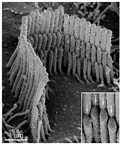 Microscopic structures called stereocilia sit atop a hair cell.