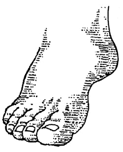 Image of a foot.