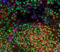 Image of a "heat map" with increased (red) or decreased (green) stem cell growth.