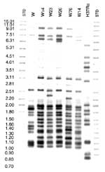 Figure 1. Southern blot hybridization of Mycobacterium tuberculosis isolates. A) IS6110-3' was used as a hybridization probe. The bracketed pattern motives regions are characteristic of the W14 family. A1 and NTF denote the bands corresponding to the IS6110 insertions in the dnaA-dnaN region and the NTF locus, respectively. Lanes 1 and 9 are standard markers; lane 2: W-MDR from New York City (W index strain); lane 3, 4, 5 and 7: members of the W14 family; lane 6: W76 and lane 8: laboratory control strain H37Ra. B) Southern blot hybridization with IS6110-5' probe. W23 and W26 each have one additional band from W14, when hybridized with either the 3' or 5' IS6110 probe. C) The polymorphic GC-rich repetitive sequence was used as a probe. The W14 group (W14; W23; W26) has a distinctive pattern when compared to all other isolates typed by polymorphic GC-rich repetitive sequence probe.
