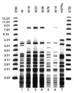 Figure 1. Southern blot hybridization of Mycobacterium tuberculosis isolates. A) IS6110-3' was used as a hybridization probe. The bracketed pattern motives regions are characteristic of the W14 family. A1 and NTF denote the bands corresponding to the IS6110 insertions in the dnaA-dnaN region and the NTF locus, respectively. Lanes 1 and 9 are standard markers; lane 2: W-MDR from New York City (W index strain); lane 3, 4, 5 and 7: members of the W14 family; lane 6: W76 and lane 8: laboratory control strain H37Ra. B) Southern blot hybridization with IS6110-5' probe. W23 and W26 each have one additional band from W14, when hybridized with either the 3' or 5' IS6110 probe. C) The polymorphic GC-rich repetitive sequence was used as a probe. The W14 group (W14; W23; W26) has a distinctive pattern when compared to all other isolates typed by polymorphic GC-rich repetitive sequence probe.
