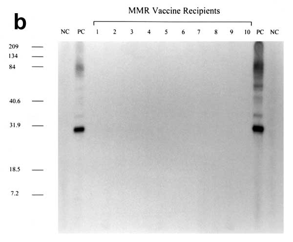 Figure 1. Western blot antibody reactivity of chicken sera to endogenous avian leukosis virus (ALV) (Rous-associated virus 0) antigen. b) NC, negative control human sera; PC, positive control: anti-p27 ALV gag antiserum; lanes 1-10, sera from measles mumps rubella vaccine recipients.