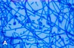 Figure 2A) Neocosmospora vasinfecta after 4 days' subculture on Sabouraud agar (lactophenol cotton blue stain, x400).