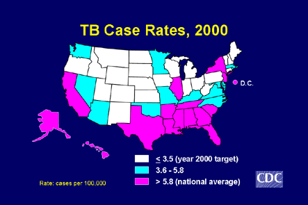 Slide 4: TB Case Rates, 2000