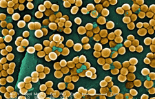 Scanning electron micrograph of methicillin-resistant Staphylococcus aureus bacteria