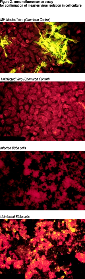 Immunofluorescence assay for confirmation of measles virus isolation in cell culture