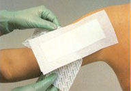 Applying a clean bandage to the upper arm
