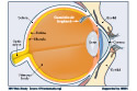 Ganciclovir Implant Before and After Intraocular Insertion 