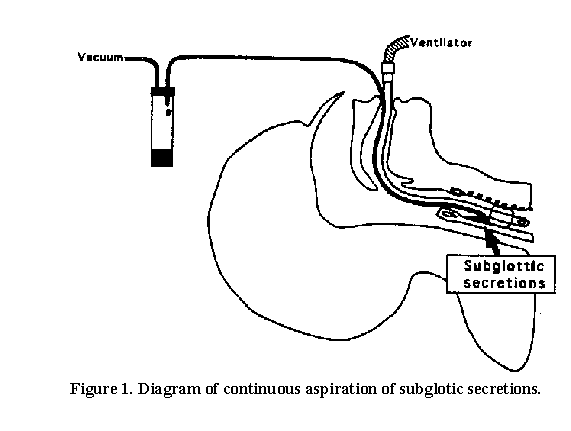 Figure 1. Diagram of continuous aspiration of subglotic secretions