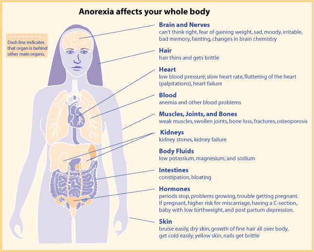 graphic on how Anorexia affects your whole body