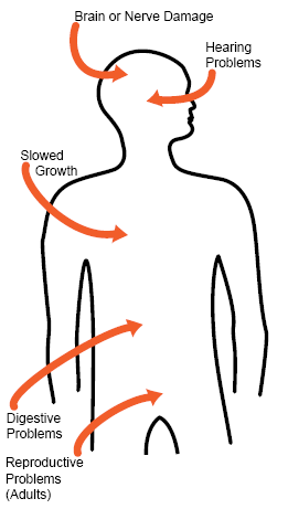A drawing of a person; how lead can affect the body.