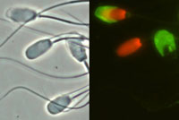 Micrograph of Sperm