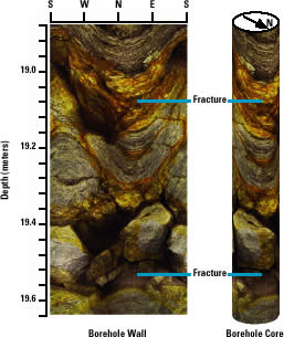 figure of the fracture