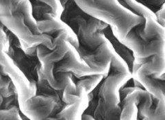micrograph of vesicle membrane