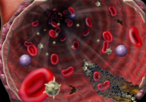 illustration of model simulating blood clotting
