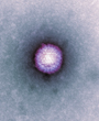 Varicella zoster virus particle - Copyright: Science Photo Library