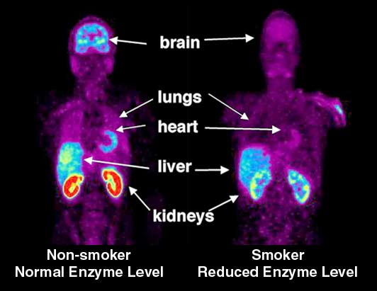 PET Scans showing effects of nicotine on the body, see text