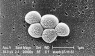 Electron micrograph of MRSA bacteria
