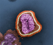 Negative-stained transmission electron micrograph depicting the structural details of an influenza virus particle.