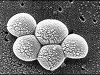Datos importantes sobre las infecciones por SARM en Estados Unidos, en las escuelas y los entornos médicos. (Title: Methicillin-resistant Staphylococcus aureus (MRSA)Created: 10/2007)
