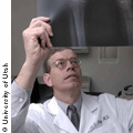 Dr. Clegg studies an x-ray of knee osteoarthritis.© University of Utah