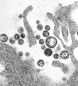 Lassa virus electron micrograph