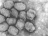 Smallpox Virus under Microscope