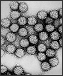 Transmission electron micrograph of intact rotavirus particles, double-shelled.