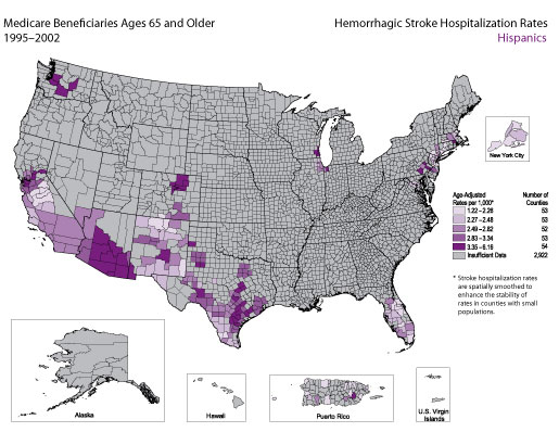 Map showing stroke hospitalization rates for hemorrhagic stroke for the Hispanic population. Refer to previous paragraph titled Hispanics for a detailed explanation of the map.