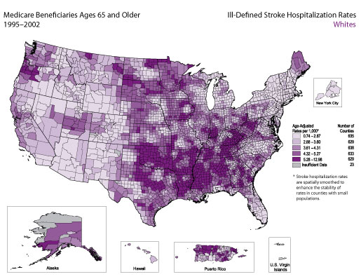 Map showing stroke hospitalization rates for ill-defined stroke for the white population. Refer to previous paragraph titled Whites for a detailed explanation of the map.