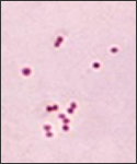 This micrograph depicts the presence of aerobic Gram-negative Neisseria meningitidis diplococcal bacteria; Mag. 1150X (Meningococcal disease is an infection caused by a bacterium called N. meningitidis or the meningococcus. The meningococcus lives in the throat of 5-10% of healthy people. Rarely, it can cause serious illness such as meningitis or blood infection).