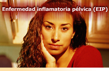 Enfermedad inflamatoria pélvica (EIP)