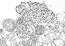 Nipah virus electron micrograph