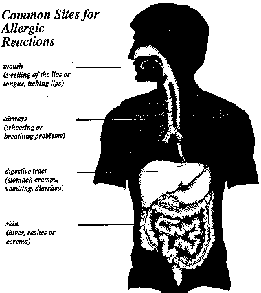 Common Sites for Allergic Reactions with human schematic labeled with - mouth (swelling of the lips or tongue, itching lips); airways (wheezing or breathing problems); digestive tract (stomach cramps, vomiting, diarrhea); skin (hives, rashes or eczema).