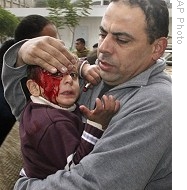 A Palestinian man carries his wounded child to the treatment room of Kamal Edwan hospital following an Israeli missile strike in Beit Lahiya, northern Gaza Strip, Monday, 29 Dec. 2008