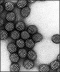magnified rotavirus