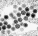 Rift Valley fever virus electron micrograph