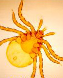 Tick image of Ixodes species