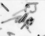 Marburg virus negative stain image