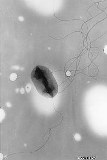scanning electron micrograph of E.coli