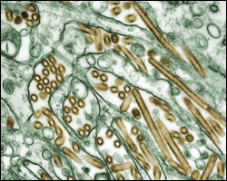 Photo: Colorized transmission electron micrograph of Avian influenza A H5N1 viruses