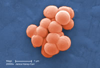 Group C Streptococcus