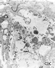 Electron micrograph